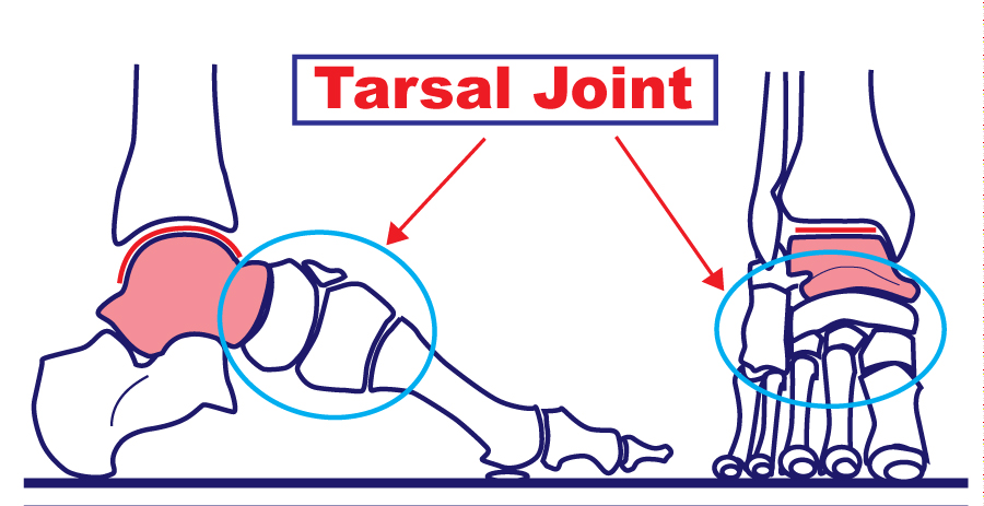 Tarsal Joint