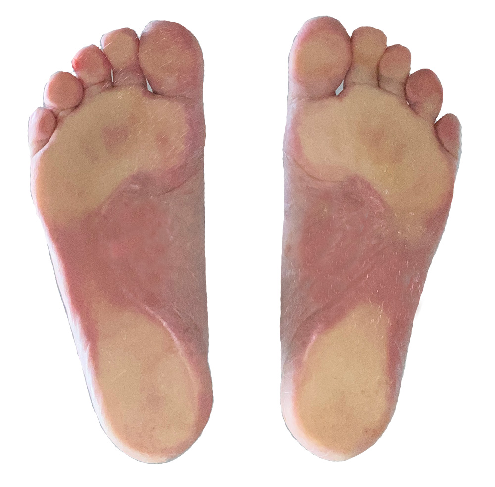 foot bottom no ortho