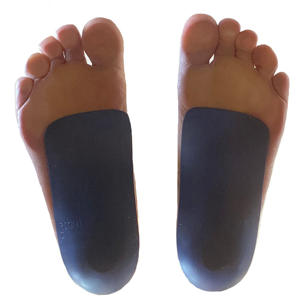 foot bottom w orthotics